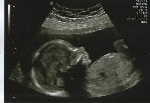 pregnant_ultrasound_Nashville_baby