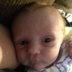 Our Daughter’s Cleft Lip :: Birth Defects Prevention Month